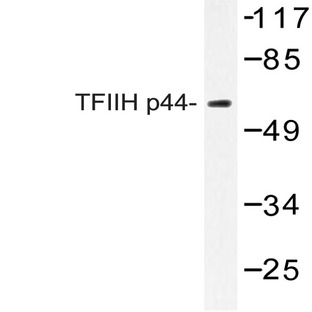 TFIIH p44 (T18) pAb