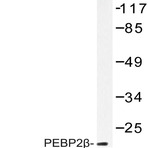 PEBP2(beta) (R33) pAb