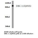 DBC-1 (Q455) pAb