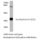 Nucleophosmin (E22) pAb