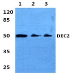 DEC2 (K31) pAb