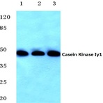 Casein Kinase I(gamma)1 (H3) pAb