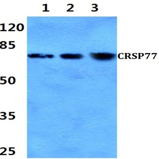 CRSP77 (V171) pAb