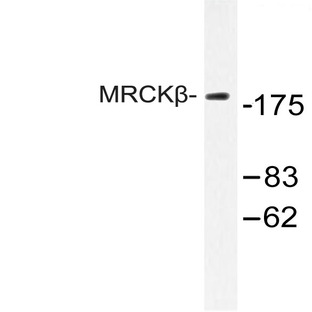 MRCK(beta) (F1665) pAb