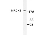 MRCK(beta) (F1665) pAb