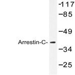 Arrestin-C (E374) pAb