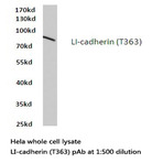 LI-cadherin (T363) pAb