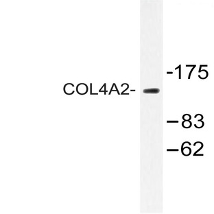 COL4A2 (P175) pAb