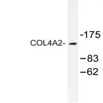 COL4A2 (P175) pAb