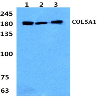 COL5A1 (E325) pAb