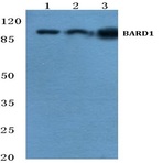 BARD1 (R8) pAb