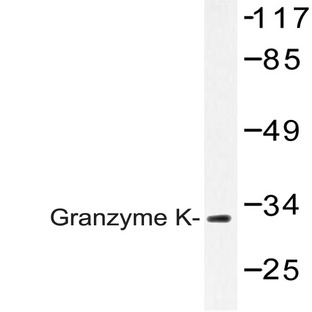 Granzyme K (H85) pAb