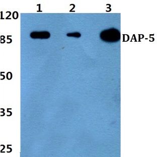 DAP-5 (N65) pAb