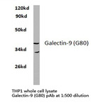 Galectin-9 (G80) pAb