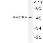 Rad51C (E185) pAb