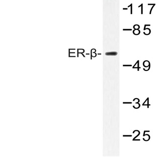 ER(beta) (E101) pAb