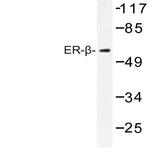 ER(beta) (E101) pAb