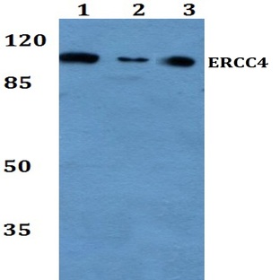 ERCC4 (A822) pAb