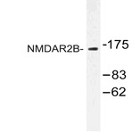 NMDAE2 (S1468) pAb