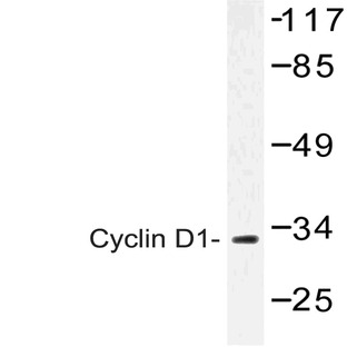 Cyclin D1 (D86) pAb