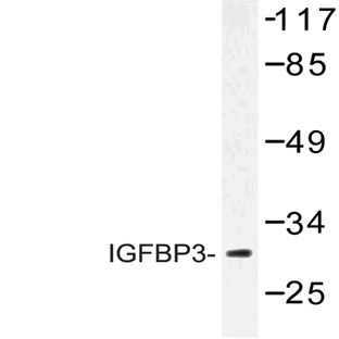 IGFBP3 (H179) pAb