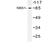 Nibrin / NBS1 (G274) pAb