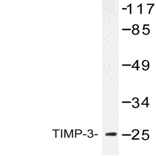 TIMP3 (N119) pAb