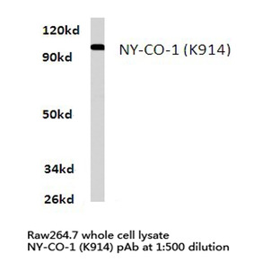 NY-CO-1 (K914) pAb