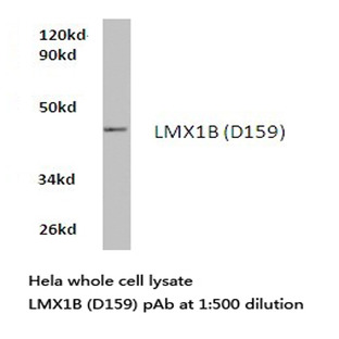 LMX1B (D159) pAb