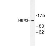 ErbB2/HER2 (K676) pAb