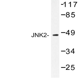 JNK2 (F280) pAb