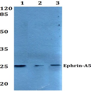 Ephrin-A5 (P63) pAb