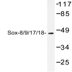 Sox8/9/17/18 (K148) pAb