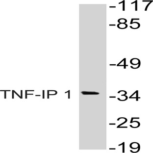 TNF-IP 1 (S122) pAb