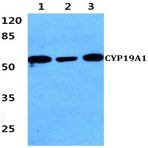 CYP19A1 (K243) pAb