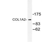 Bs2522_wb