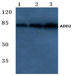 Adducin (beta) (E497) pAb