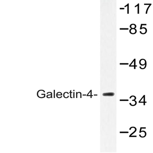 Galectin-4 (K83) pAb