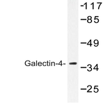 Galectin-4 (K83) pAb