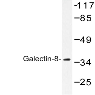 Galectin-8 (N82) pAb