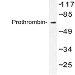 Prothrombin (G724) pAb