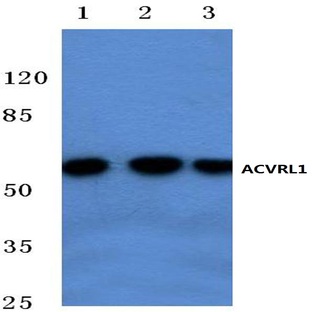 ACVRL1 (F231) pAb