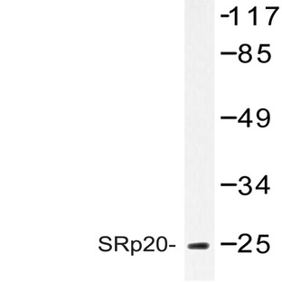 SRp20 (F151) pAb