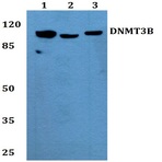 Bs2572_wb