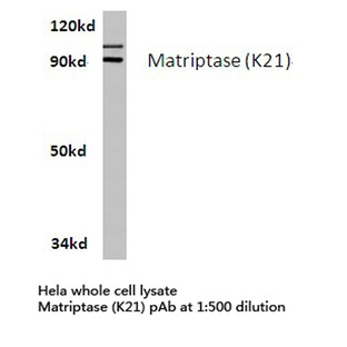 Matriptase (K21) pAb