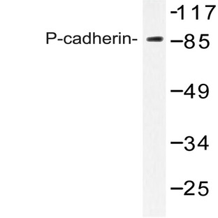 P-cadherin (G78) pAb