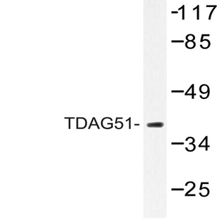 TDAG51 (A149) pAb