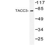 TACC3 (T813) pAb