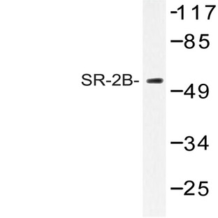 SR-2B (H55) pAb