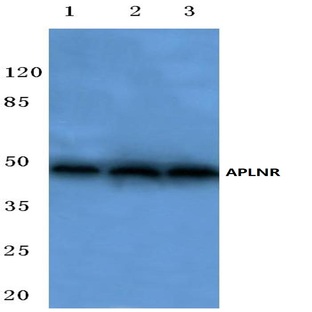 APLNR (C181) pAb